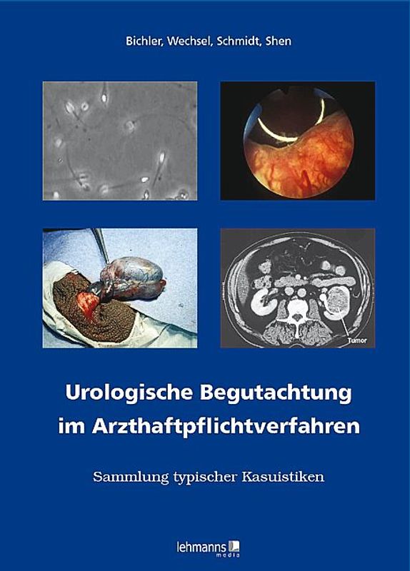Urologische Begutachtung im Arzthaftpflichtverfahren