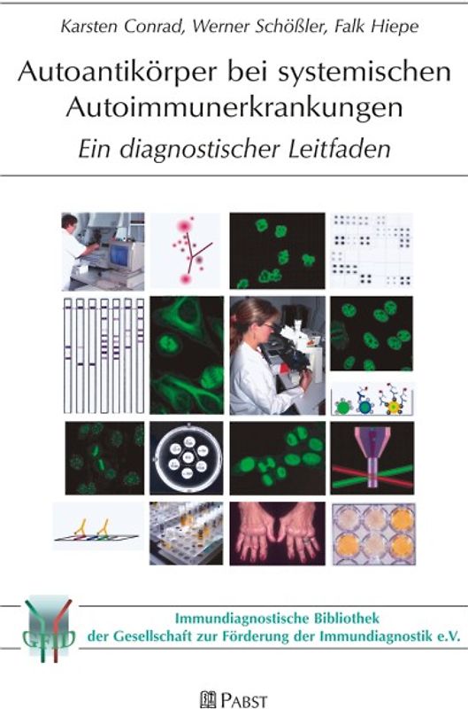 Autoantikörper bei systemischen Autoimmunerkrankungen