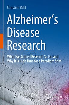 Alzheimer’s Disease Research