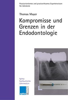 Kompromisse und Grenzen in der Endodontologie