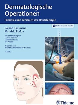 Dermatologische Operationen: Farbatlas und Lehrbuch der Hautchirurgie