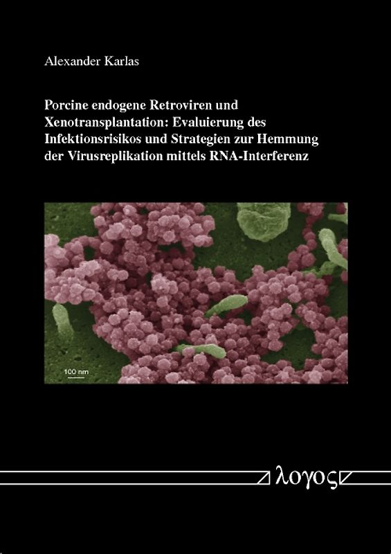 Porcine endogene Retroviren und Xenotransplantation: Evaluierung des Infektionsrisikos und Strategien zur Hemmung der Virusreplikation mittels RNA-Interferenz
