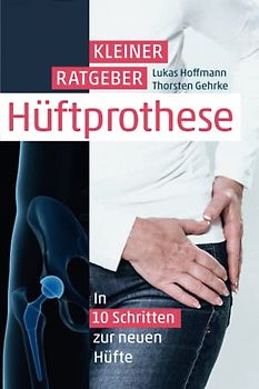 Kleiner Ratgeber Hüft-Prothese 2021: In 10 Schritten zur neuen Hüfte