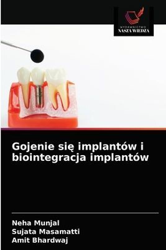 Gojenie si¿ implantów i biointegracja implantów