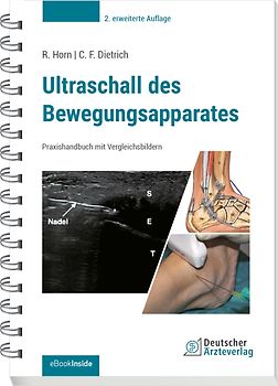 Ultraschall des Bewegungsapparates