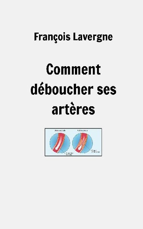 Comment déboucher ses artères