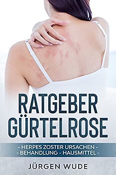 Ratgeber Gürtelrose: Herpes Zoster Ursachen Behandlung Hausmittel