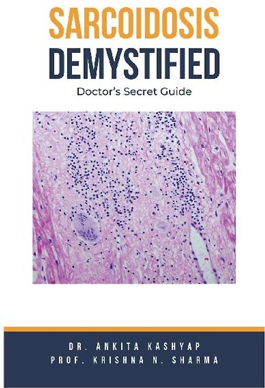 Sarcoidosis Demystified