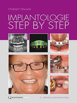 Implantologie Step by Step