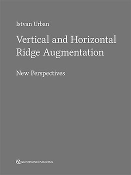 Vertical and Horizontal Ridge Augmentation