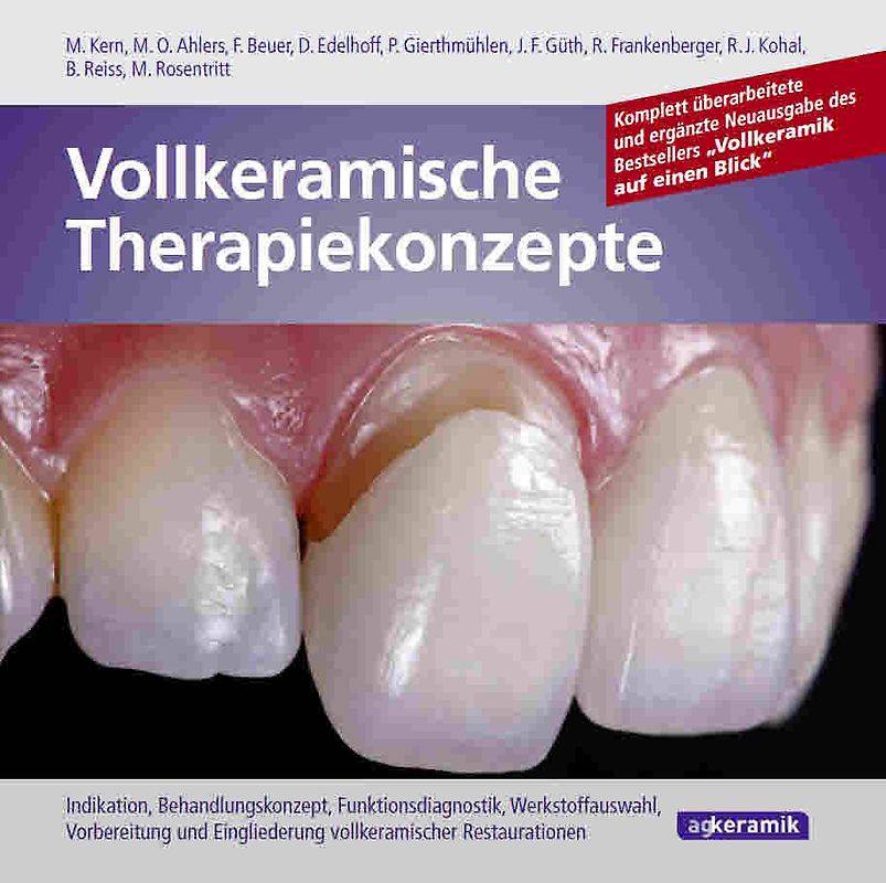 Vollkeramische Therapiekonzepte