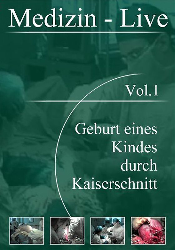 Medizin Live, Vol. 01 - Geburt eines Kindes durch Kaiserschnitt DVD