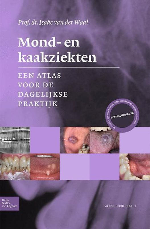 Mond- en kaakziekten