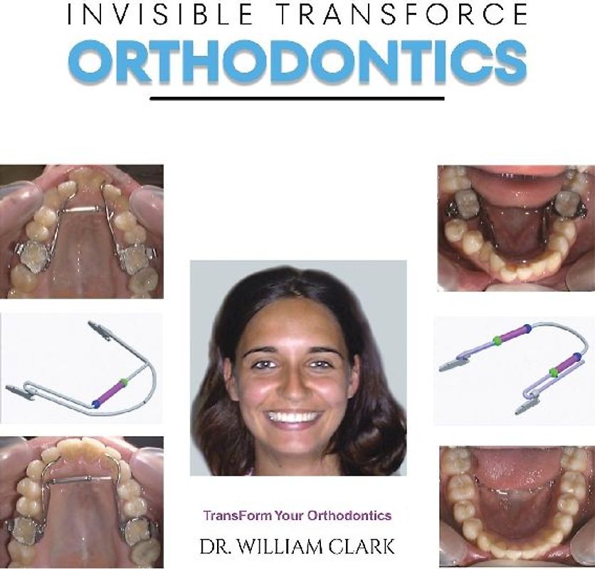 Invisible TransForce Orthodontics