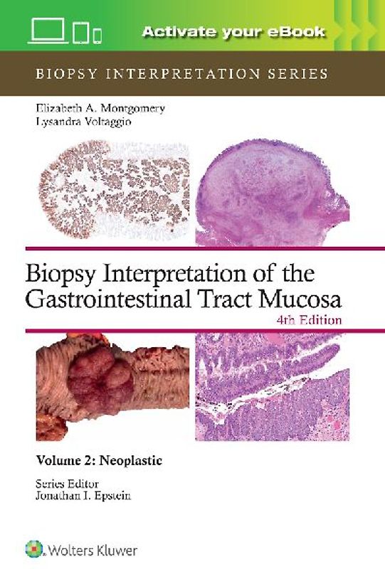 Biopsy Interpretation of the Gastrointestinal Tract Mucosa Volume 2