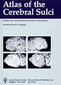 Atlas of the Cerebral Sulci