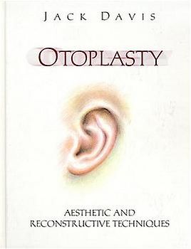 Otoplasty