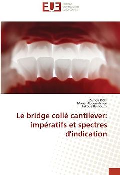Le bridge collé cantilever: impératifs et spectres d'indication