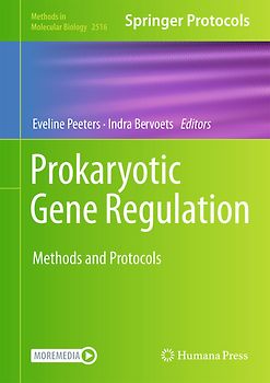 Prokaryotic Gene Regulation