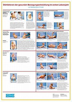 Störfaktoren der gesunden Bewegungsentwicklung im ersten Lebensjahr