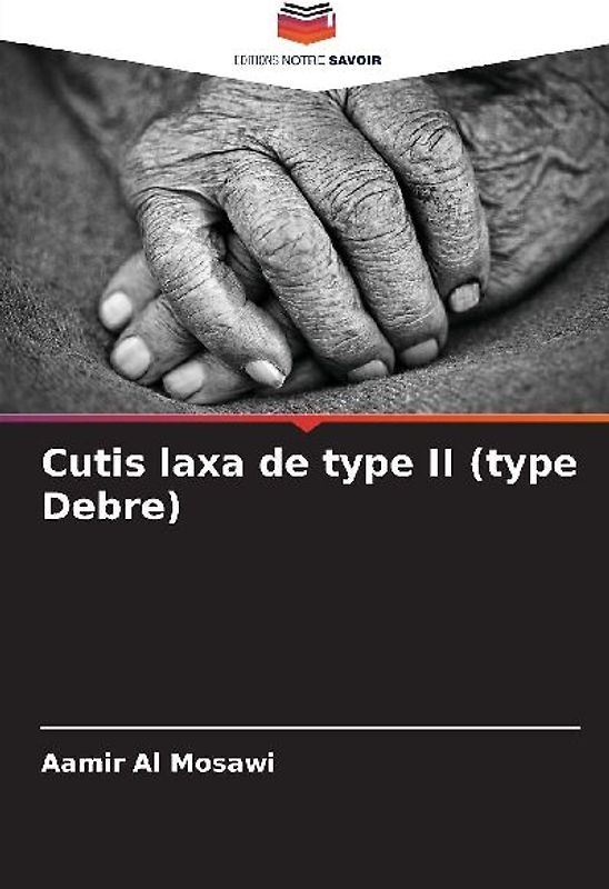 Cutis laxa de type II (type Debre)
