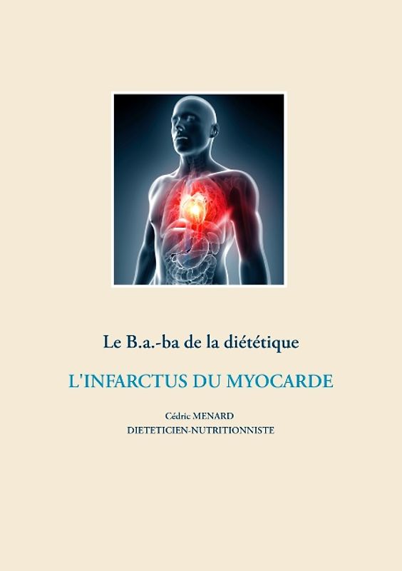 Le B.a.-ba de la diététique après un infarctus du myocarde
