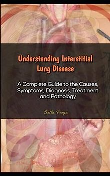 Understanding Interstitial Lung Disease: A Complete Guide to the Causes, Symptoms, Diagnosis, Treatment and Pathology
