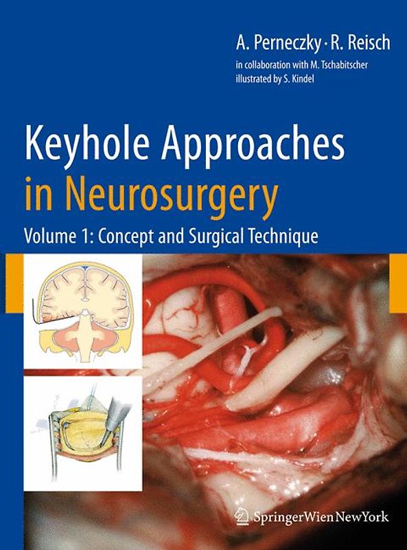 Keyhole Approaches in Neurosurgery