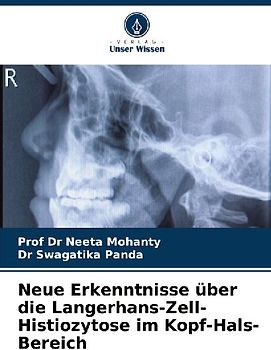 Neue Erkenntnisse über die Langerhans-Zell-Histiozytose im Kopf-Hals-Bereich