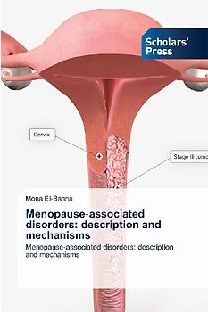 Menopause¿associated disorders: description and mechanisms