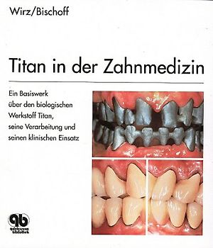 Titan in der Zahnmedizin