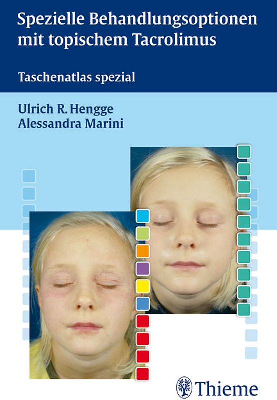 Spezielle Behandlungsoptionen mit topischem Tacrolimus