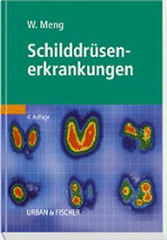 Schilddrüsenerkrankungen