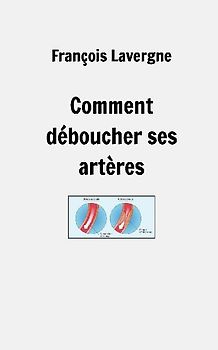 Comment déboucher ses artères