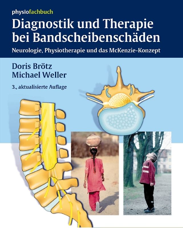 Diagnostik und Therapie bei Bandscheibenschäden