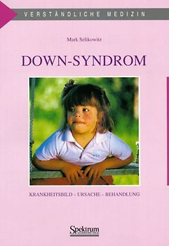 Down-Syndrom