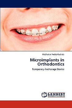 Microimplants in Orthodontics