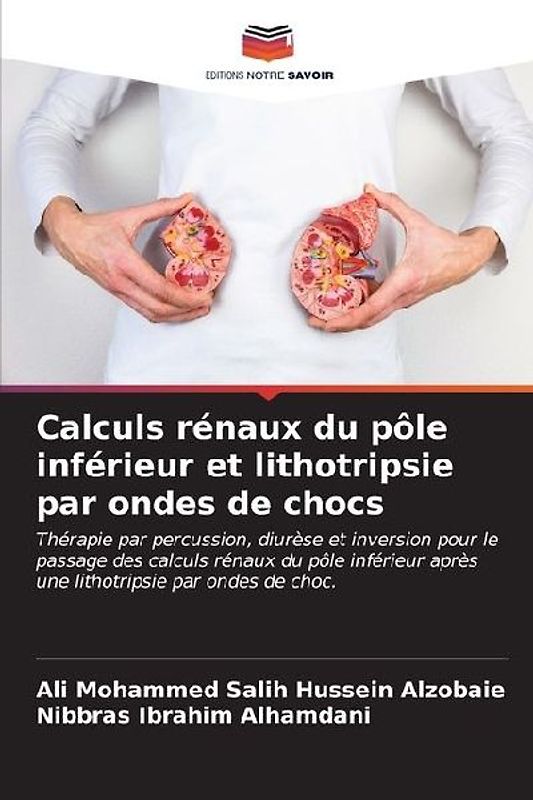 Calculs rénaux du pôle inférieur et lithotripsie par ondes de chocs