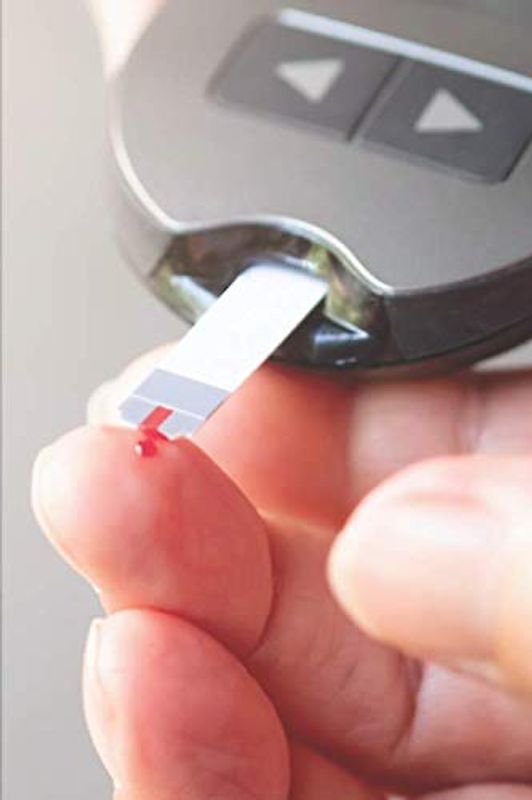 Blutzucker Tagebuch: für Diabetiker zur täglichen Messung von Blutdruck, Blutzucker, Insulin ♦ handliches 6x9 Format ♦ Motiv: Messgerät 6
