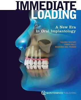 Immediate Loading: A New Era in Oral Implantology - Tiziano Testori