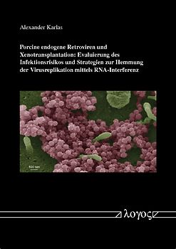 Porcine endogene Retroviren und Xenotransplantation: Evaluierung des Infektionsrisikos und Strategien zur Hemmung der Virusreplikation mittels RNA-Interferenz