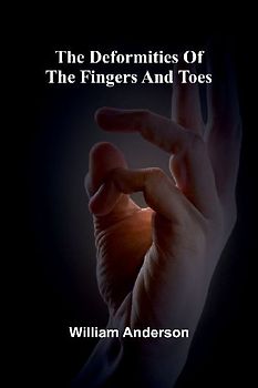 The Deformities Of The Fingers And Toes