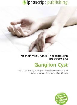 Ganglion Cyst