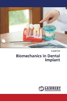 Biomechanics in Dental Implant
