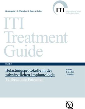 Belastungsprotokolle in der zahnärztlichen Implantologie
