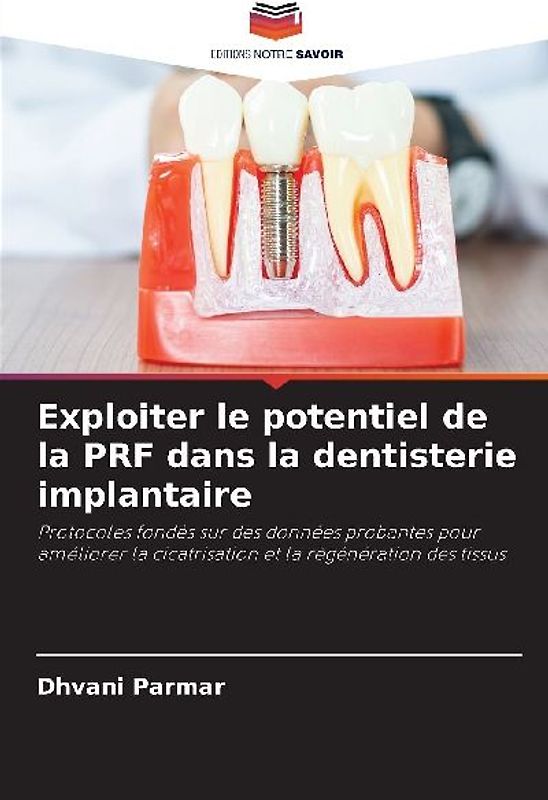 Exploiter le potentiel de la PRF dans la dentisterie implantaire