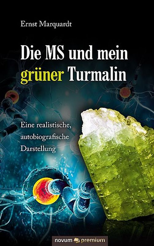 Die MS und mein grüner Turmalin