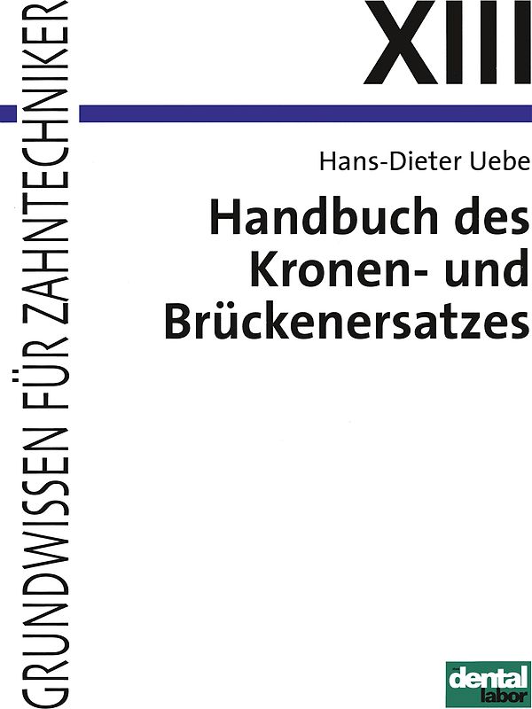 Handbuch des Kronen- und Brückenersatzes