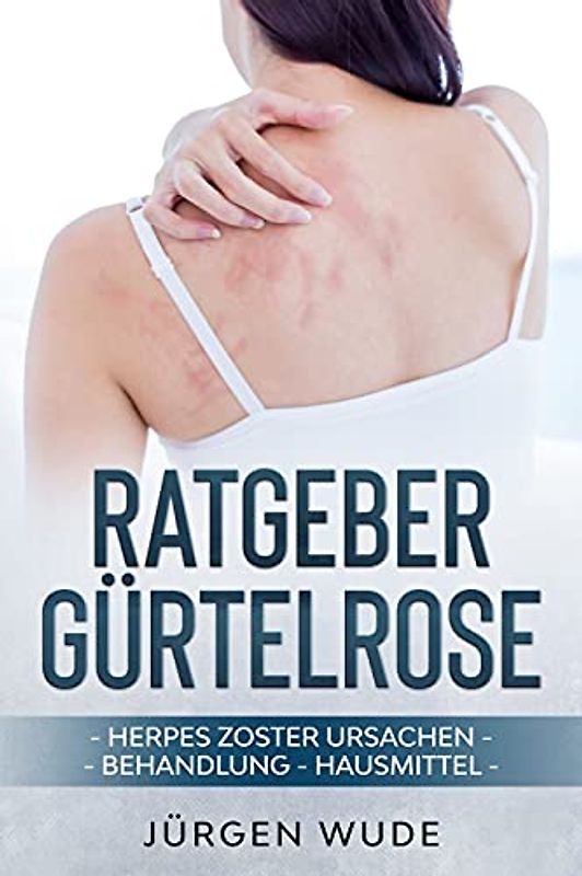 Ratgeber Gürtelrose: Herpes Zoster Ursachen Behandlung Hausmittel