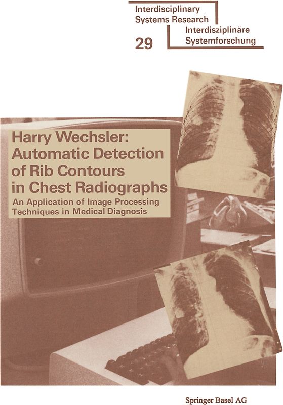 Automatic Detection of Rib Contours in Chest Radiographs
